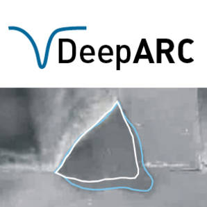 DeepARC